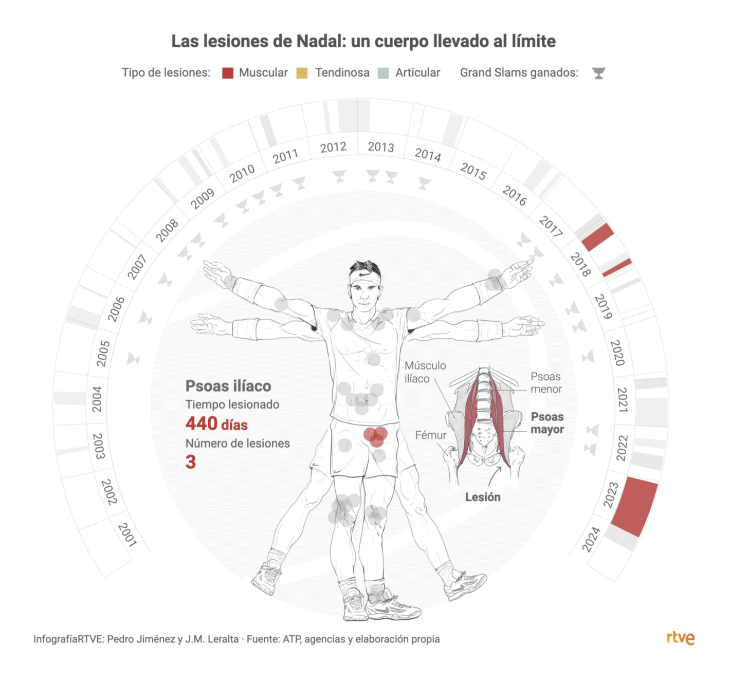 RTVE / Pedro Jiménez: "Rafa Nadal anuncia su retirada del tenis profesional. 22 Grand Slams... ¿Qué habría sido de él si el cuerpo le hubiera respetado un poquito más con las lesiones? [...]," [<em>Chart title: Nadal's injuries: a body pushed to the limit</em>] October 10 (<a href="https://x.com/PedroJimnez/status/1844386455680172084/photo/4"><strong>Tweet</strong></a>, <a href="https://www.rtve.es/deportes/20241010/rafa-nadal-lesiones-retirada/16020384.shtml"><strong>Article</strong></a>)