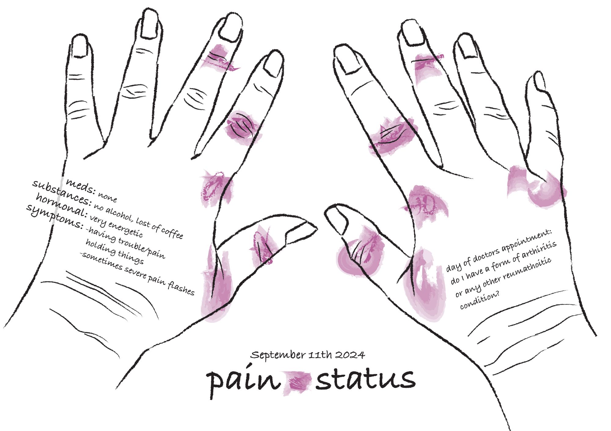Sonja Kuijpers | STUDIO TERP: "Like a true self reporting data illustrator I started tracking the pain in the joints of my hands [...]" September 25 (<strong><a href="https://bsky.app/profile/sonjakuijpers.bsky.social/post/3l4xrmhlgmh2x">Bluesky</a></strong>)